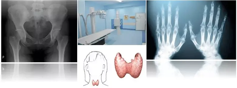 Ambulanta za bolezni ščitnice koncesija Maribor