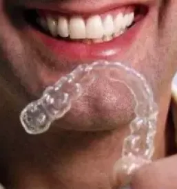 Kvalitetni zobni implantati ljubljana