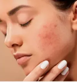 Zasebni dermatolog v ljubljani