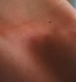Zasebni dermatolog v ljubljani