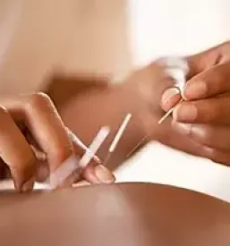 Manualne tehnike koper