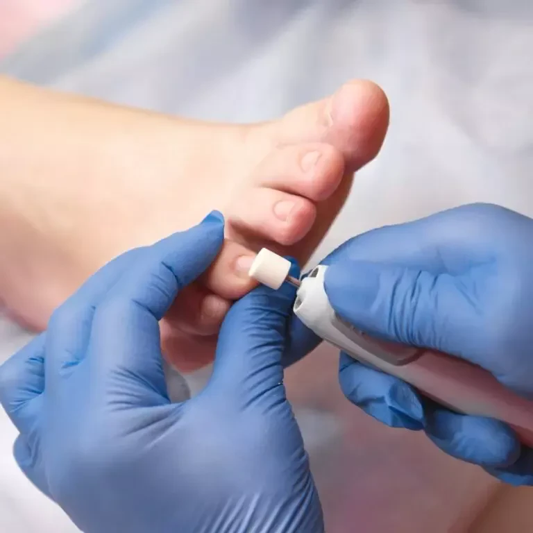 Medicinska pedikura Osrednja Slovenija