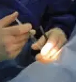 Operacija sive mrene