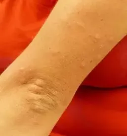 Pulmolog murska sobota