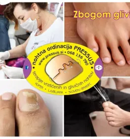 Terapije glivicnih obolenj na nohtih koroska