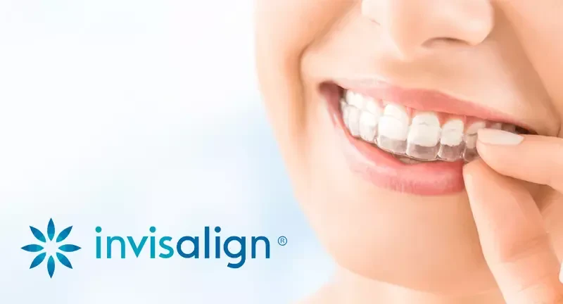 Nevidni zobni aparat in Invisalign Ljubljana, okolica 