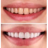 Dental harmony - zasebna zobna ambulanta