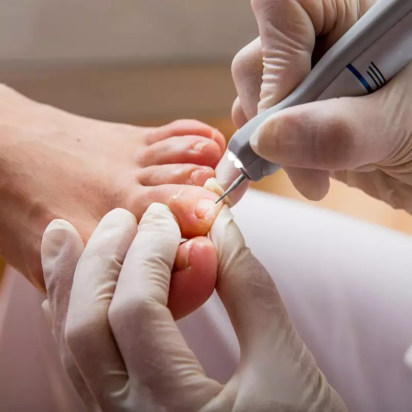 Ugodna medicinska pedikura Osrednja Slovenija