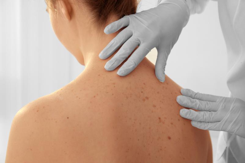 Zasebni dermatolog v Ljubljani