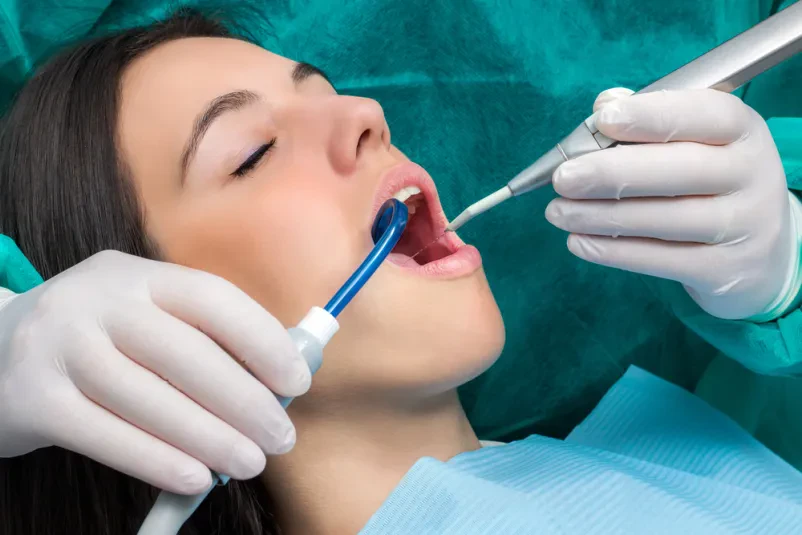Implantati Nova Gorica