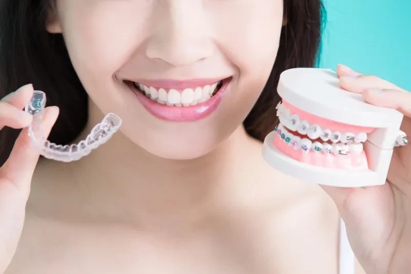Invisalign diamond provider Slovenija