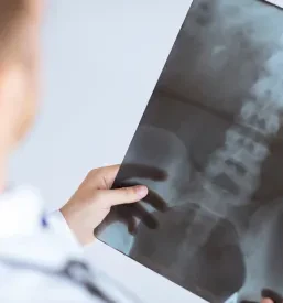 Pomoč pri preprečevanju osteoporoze Hrastnik