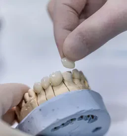 Ceramic composites