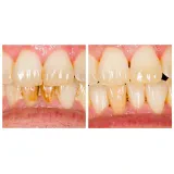 JPV dental d.o.o.