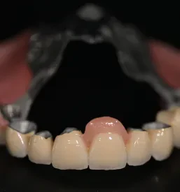 Estetska zobna protetika Dental Spectrum