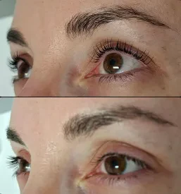 Keratinsko vihanje trepalnic Ljubljana BTC, Osrednja Slovenija