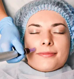 RF microneedling za obnovo kože Ljubljana